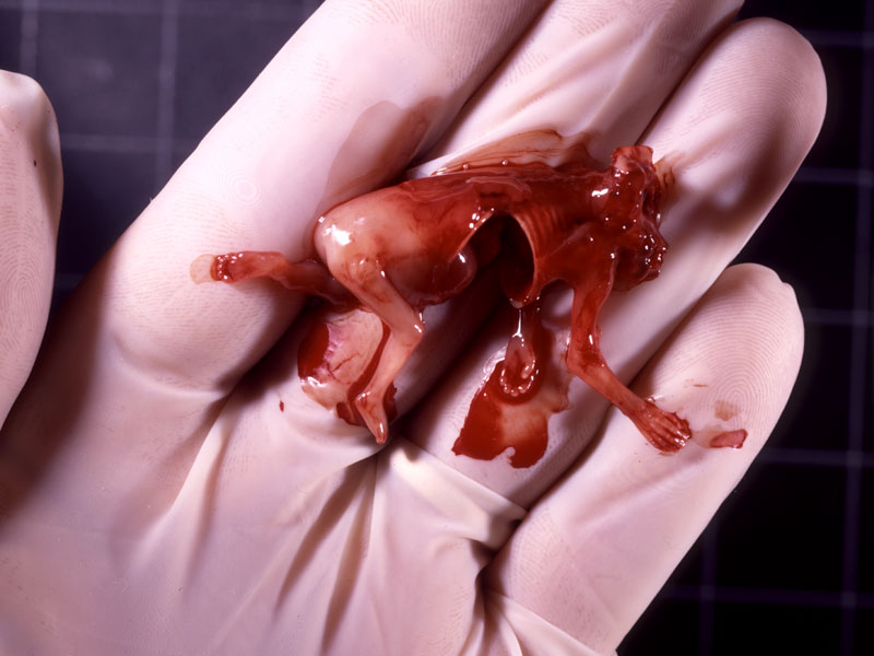 abortion 8 weeks. an 11 week old. this is how